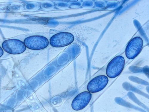 Scutellinia olivascens - 