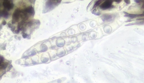 Nematostoma - 3fach septiert / haarig - 