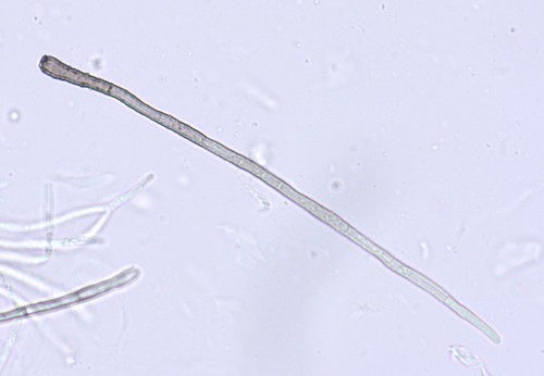 Nematostoma - 3fach septiert / haarig - 