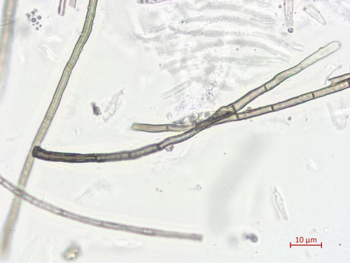 Nematostoma - 3fach septiert / haarig - 