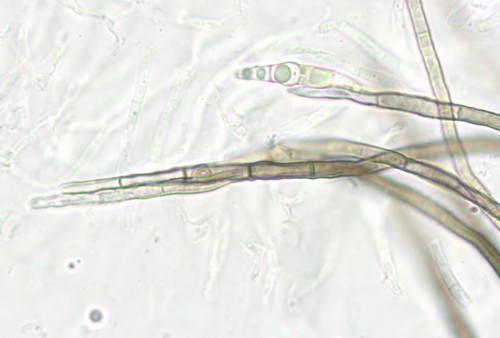Nematostoma - 3fach septiert / haarig - 