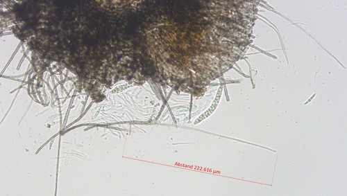 Nematostoma - 3fach septiert / haarig - 