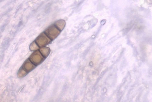 Hysterium acuminatum - 