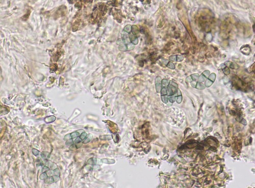 Dactylospora microspora - 