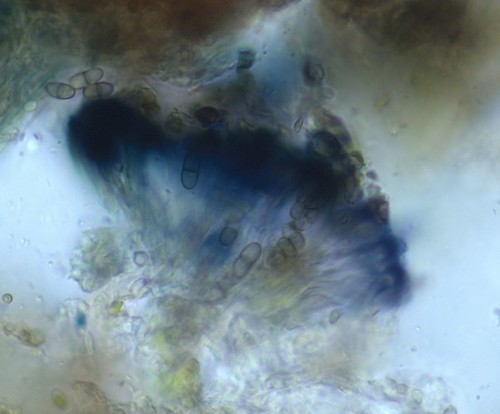 Dactylospora microspora - 