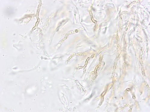 Globulisebacina badioumbrina - 