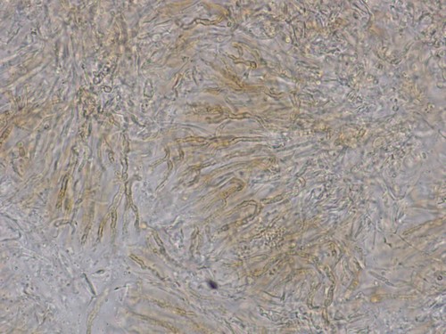 Globulisebacina badioumbrina - 