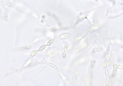 Globulisebacina badioumbrina - 