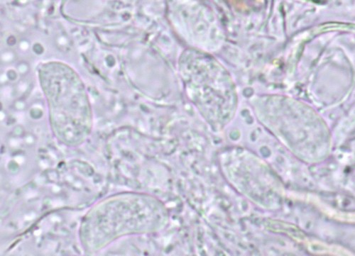 Globulisebacina badioumbrina - Spore/n - Wasser  - 