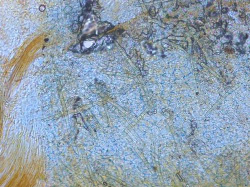 Cheilymenia crucipila - 