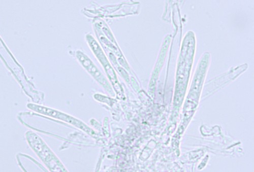 Psilachnum chrysostigmum - Asci & Paraphysen - Wasser  - 