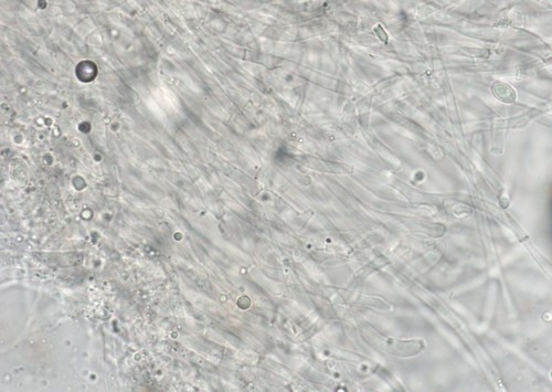 Clitopilus cystidiatus - HDS - Wasser  - 