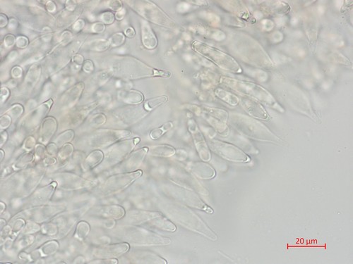 Leccinellum pseudoscabrum - Cheilozystiden - 