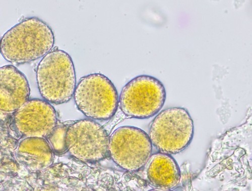 Kuehneola uredinis - Uredosporen - Wasser  - 