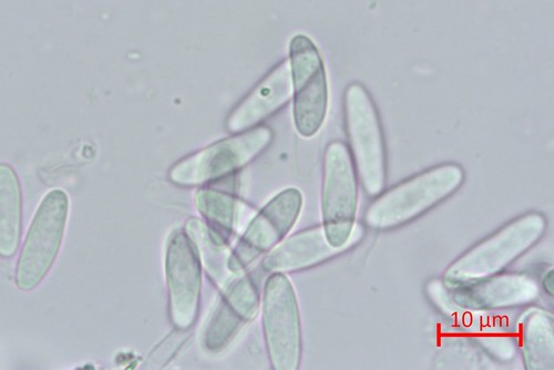 Cudoniella clavus - 