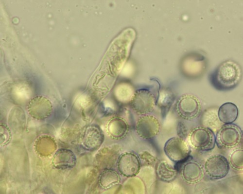 Fayodia bisphaerigera - Spore/n - Melzers  - 