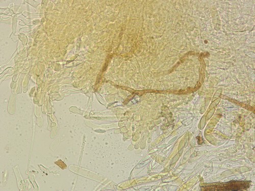 Rhodoscypha ovilla - Haare - 