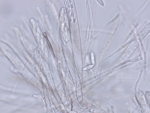 Ascocoryne sarcoides - 