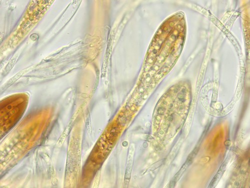 Coccomyces tumidus - Ascus - Baral  - 