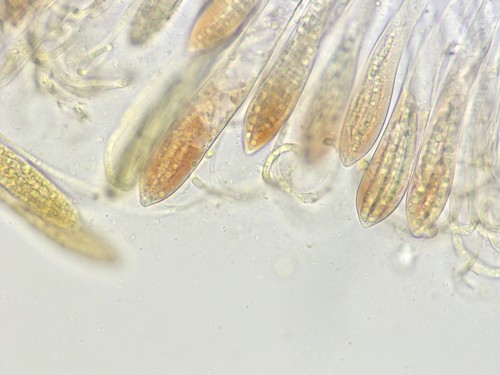 Coccomyces tumidus - Asci - Baral  - 