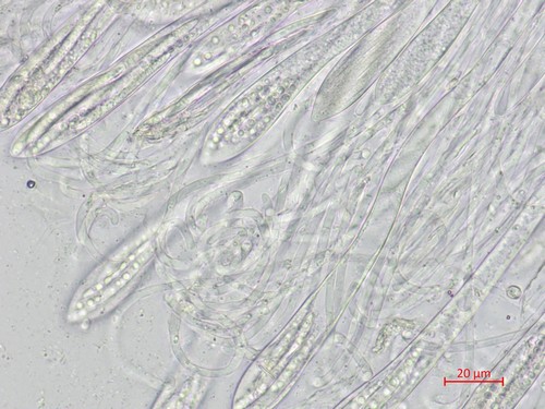 Coccomyces tumidus - Asci & Paraphysen - Wasser  - 