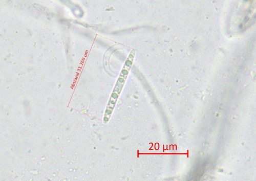 Coccomyces tumidus - Spore/n - Wasser  - 