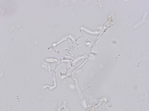 Corticium roseum - 