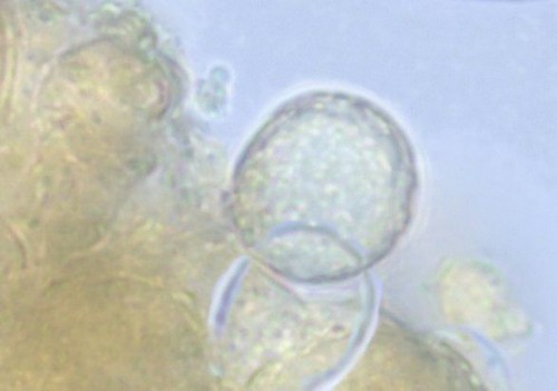 Amanita vaginata var. alba - Spore/n - Melzers  - 