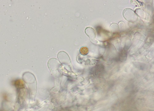 Cortinarius venetus var. venetus - Cheilozystiden - 