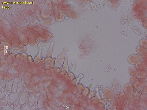 Rhizomarasmius setosus - Zystiden - Kongorot  - 