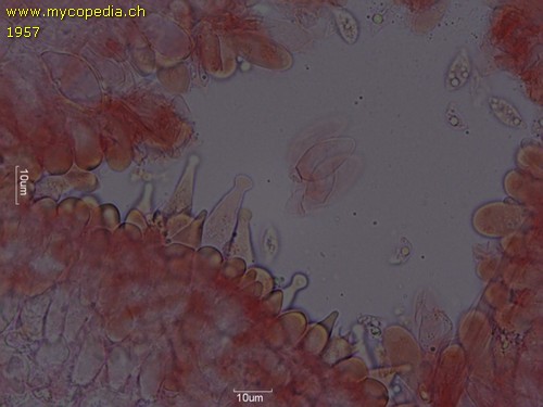 Rhizomarasmius setosus - Zystiden - Kongorot  - 