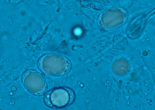 Helvella elastica - Spore/n - Patentblau  - 
