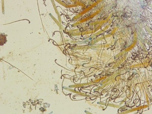 Geoscypha tenacella - 