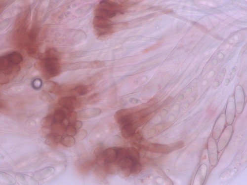Gyromitra infula - Paraphysen - KOH  - 
