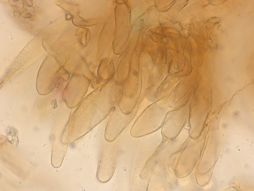 Entoloma hirtum - Cheilozystiden - 