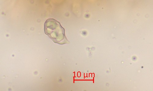 Entoloma hirtum - Spore mit Pedizelle - 