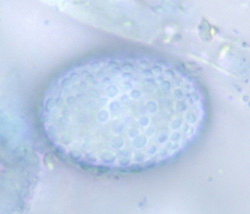Scutellinia parvispora - 