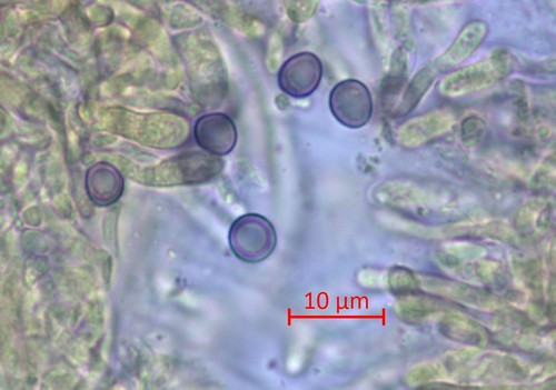 Hericium erinaceus - Spore/n - Melzers  - 