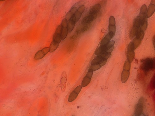 Kirschsteiniothelia aethiops - 