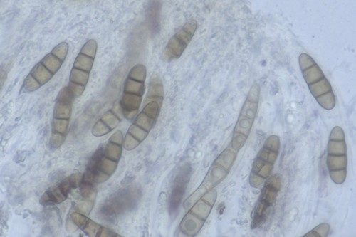 Hysterium angustatum - 
