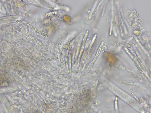 Mollisia ligni - Paraphysen - Wasser  - 