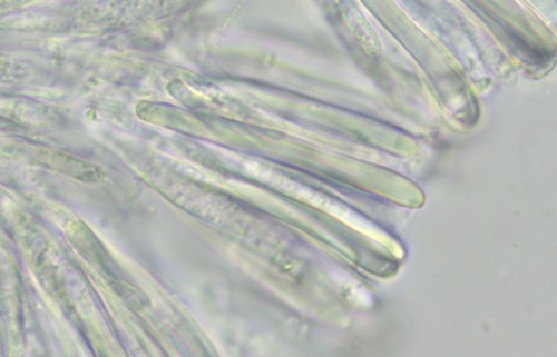Pezizella alniella - Paraphysen - 