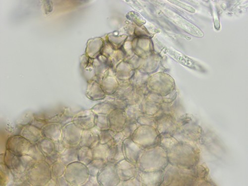 Pezizella alniella - Excipulum - Wasser  - 