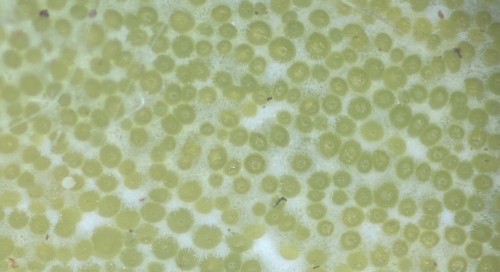 Epichloe typhina - 