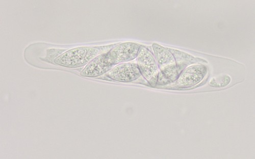 Wuestneia chrysostroma - Sporen & Asci - Wasser  - 