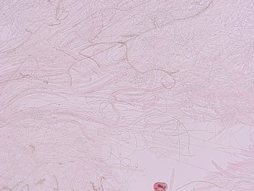 Ostropa barbara - 