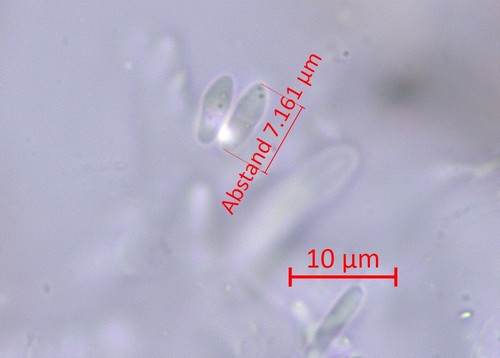 Wentiomyces fimbriatus - Sporen & Asci - Wasser  - 