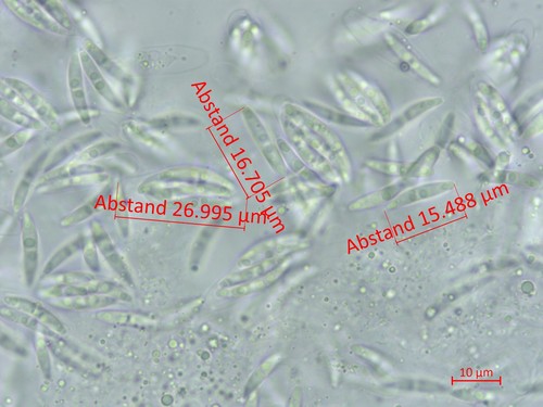 Apiognomonia hystrix - Spore/n - Wasser  - 