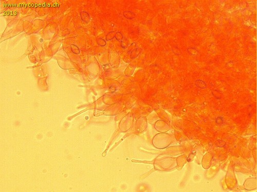 Naucoria amarescens - Cheilozystiden - 