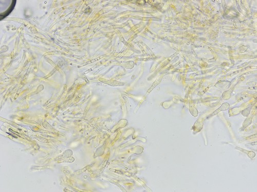 Pezicula ocellata - Paraphysen - Wasser  - 
